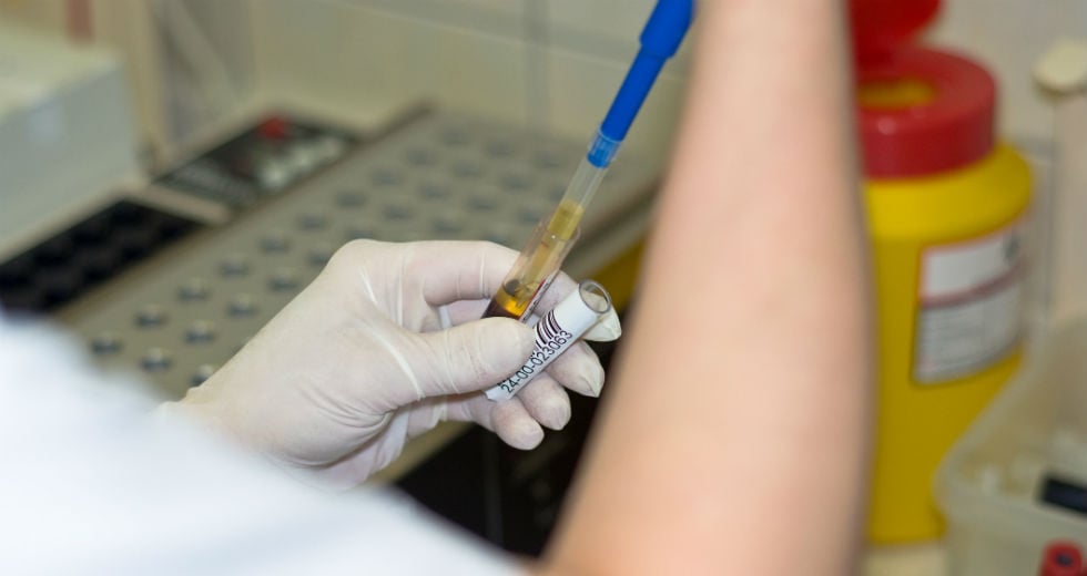 Τεστ αίματος για τον καρκίνο του στήθους από Γερμανούς επιστήμονες